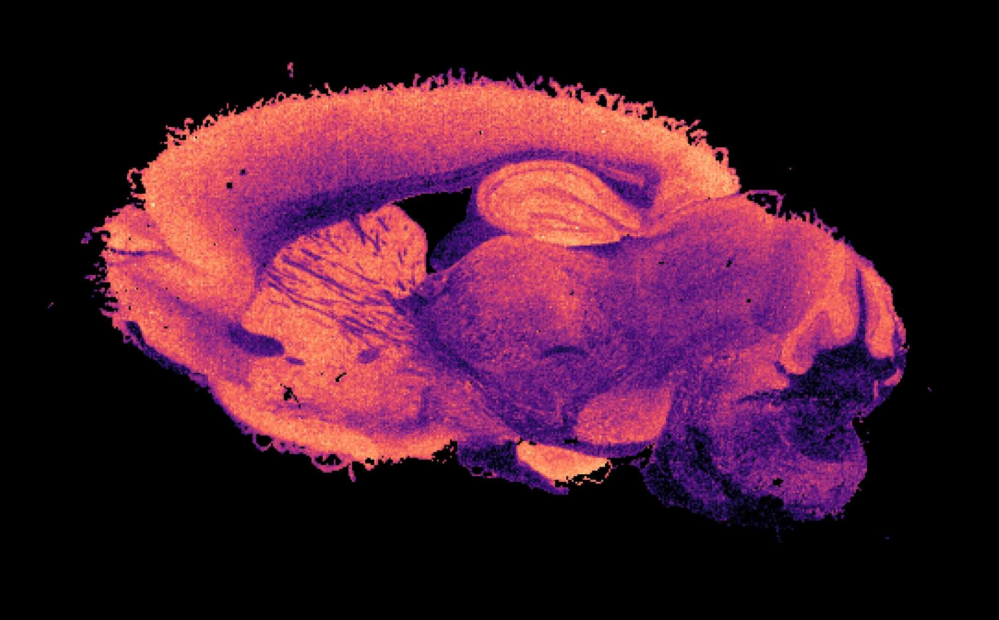 Picture of a slice of mouse brain in which a specific molecule is visible